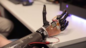 Doi soldați ucraineni care și-au pierdut câte o mână în război au primit brațe bionice de ultimă generație