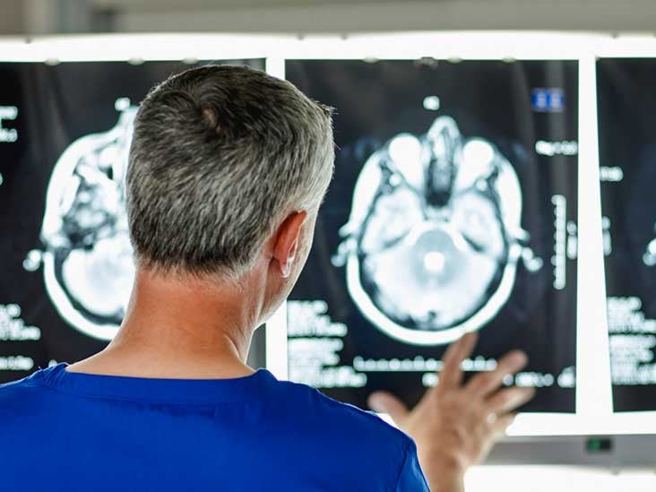 Un nou instrument cu Inteligență Artificială poate prezice dacă persoanele cu risc sunt susceptibile de a avea boala Alzheimer în viitor