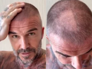 David Beckham a vrut să-și surprindă fanii cu un nou look, dar s-a ales cu o porțiune cheală în cap. Cum a reacționat soția sa